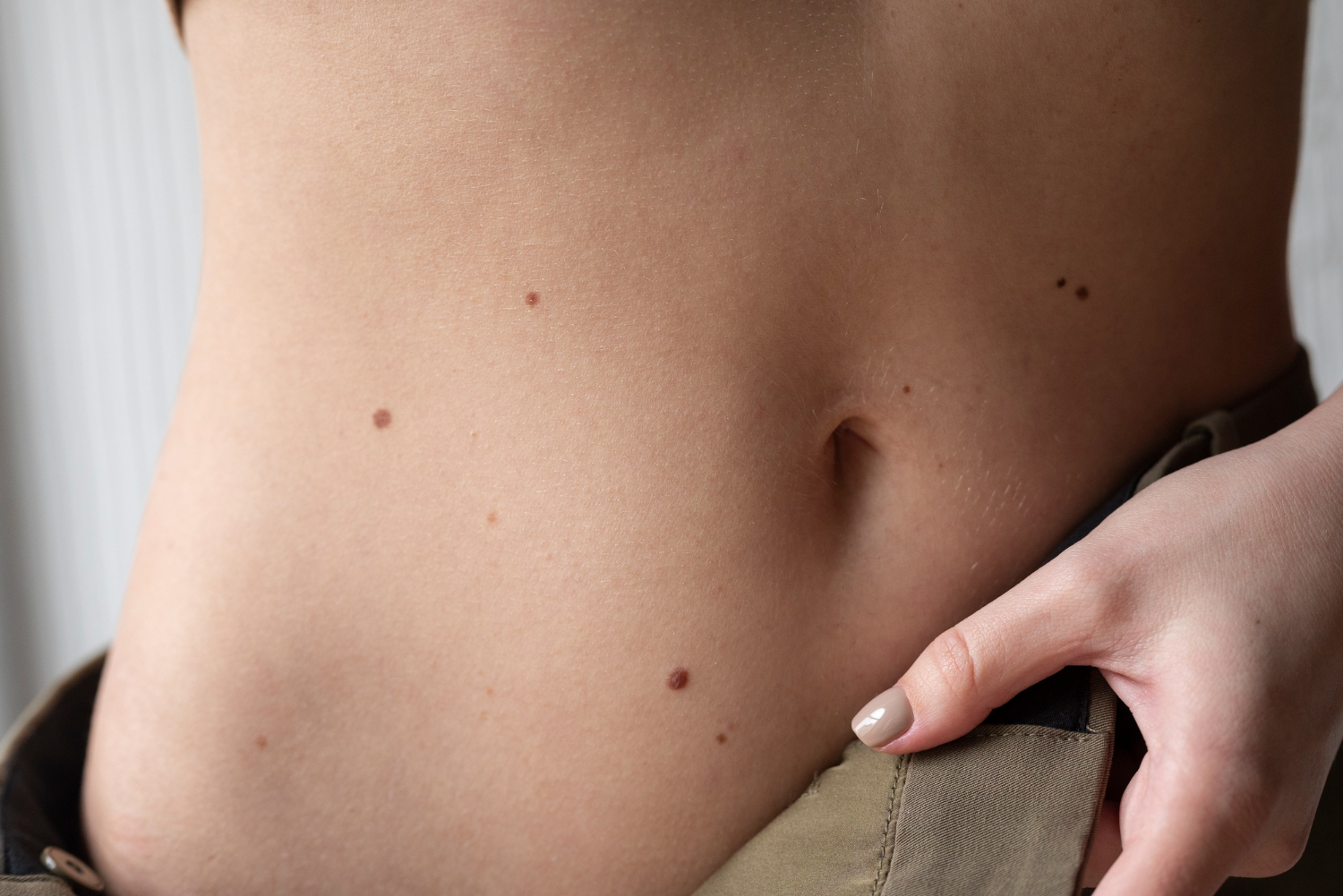 Top Skin Tag Treatment Solutions